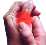 RHEUMATISM