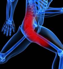 SCIATICA_PAIN