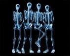 Radiography career